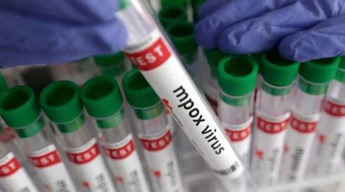 Mpox: Portugal vai doar vacinas a países africanos
